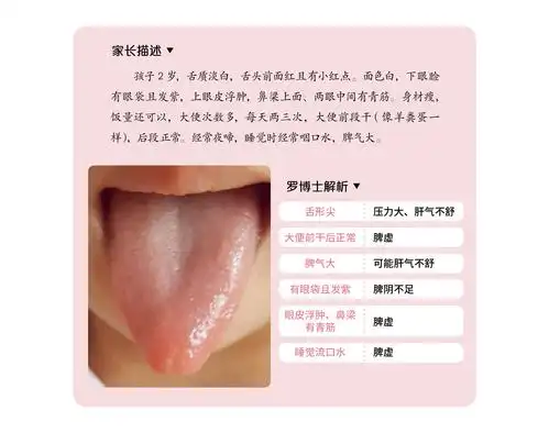 试听180秒38.肝气不舒的孩子,可能脾虚,湿气重