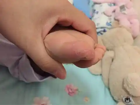 宝宝脚丫大拇指脱皮