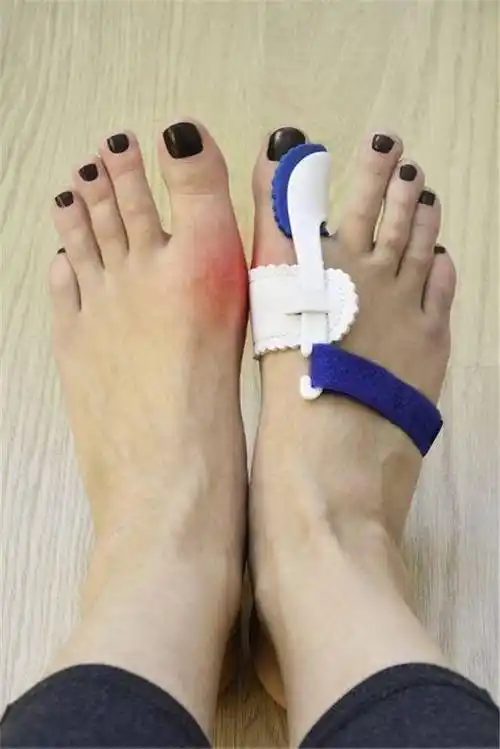 原创长期穿高跟鞋的女生几年后会有什么变化过来人说出了真相