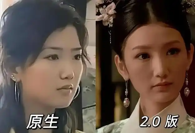 网友质疑毛晓彤整容!在《庆余年》里,假体都要飞出来了!太吓人