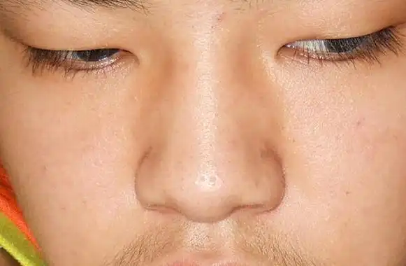 死鱼眼的人面相解说 双目无神影响颜值 命运平庸无所成就