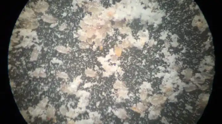 写美篇发现螨虫喜欢在床垫,被子角角落落里聚集,一床完整的被子被