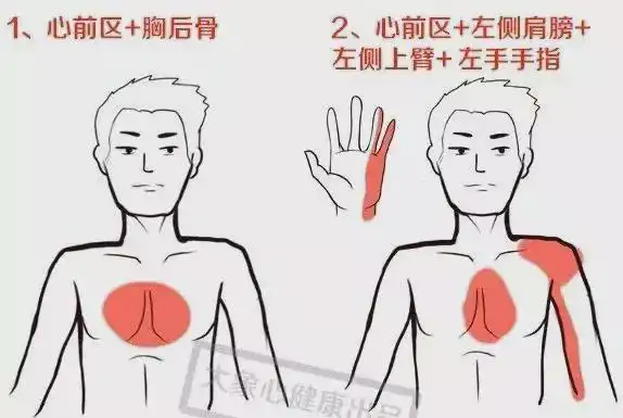 挽救心梗关键3步,从注意这些小症状开始|心绞痛|冠心病|心肌_网易订阅