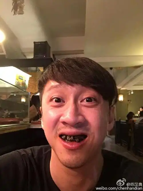 陈汉典洗牙后晒自黑自拍满口黑牙扮丑