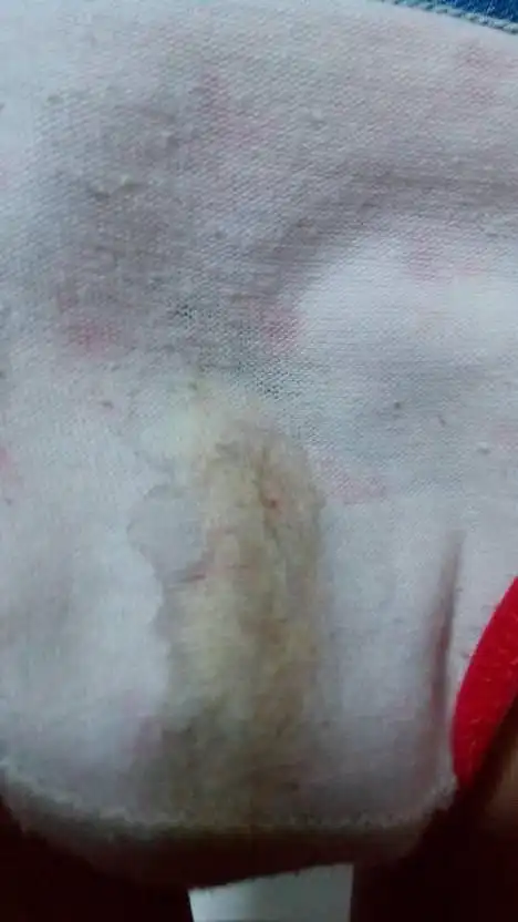 我11,女,小学,我的白带正常不?