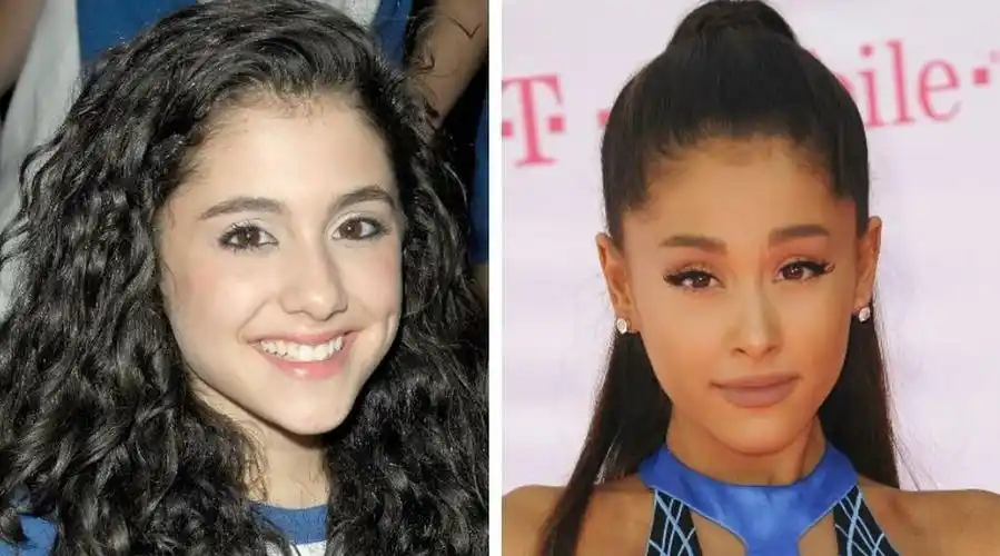 详解a妹做的5个整容项目和花费. 她大概是从小天使变成了上帝吧?