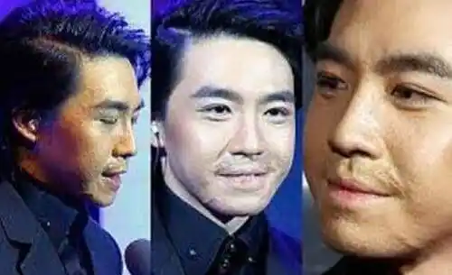 俞灏明烧伤前后对比细节俞灏明和selina怎么烧伤的事件始末