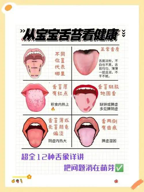 宝宝积食  #宝宝脾胃 #宝宝积食怎么办   #科学育儿我有妙招  #舌诊