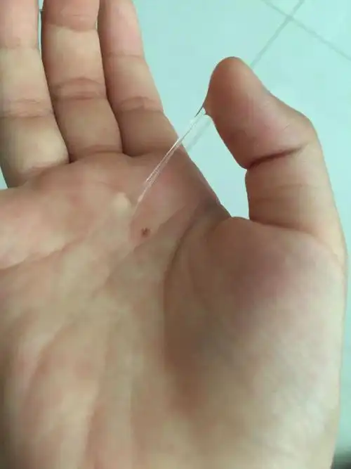 这是什么东西,最近尿尿的地方总有这个,还特别多,透