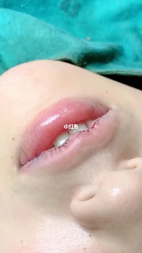 m唇_唇_美妆_医美整形