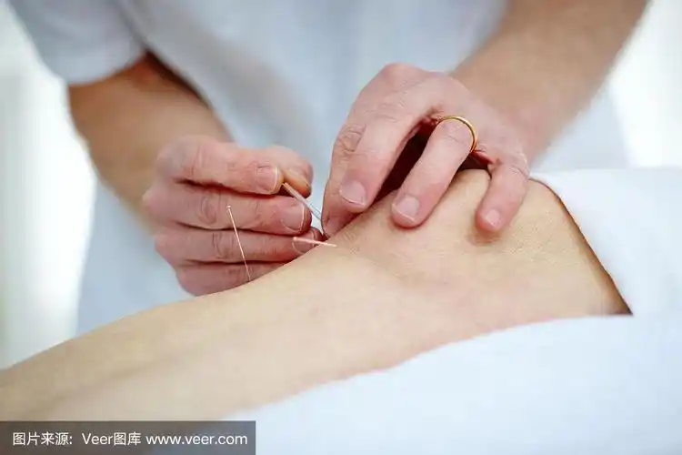 在病人的膝盖上做针灸的理疗师