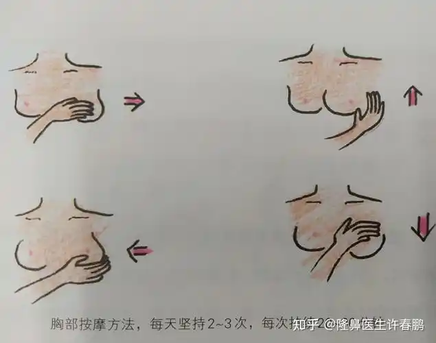 隆乳手术后需要按摩嘛如何按摩