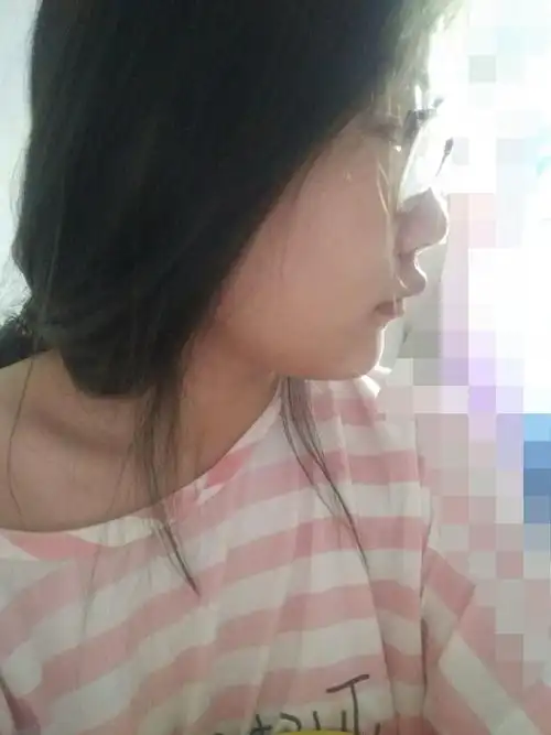 上嘴唇上翘上翻怎么办侧面看起来简直丑哭我