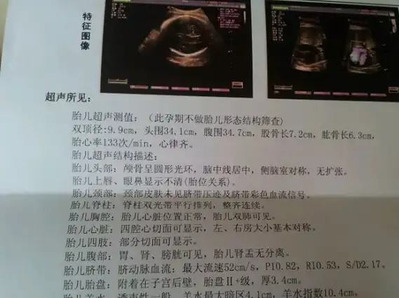 对于女生来说比较小一些,孕囊的话是用三个数据相乘来表示的,假如你