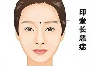 对人生很重要,此部位如得美痣,古称双龙抢珠,此相意志坚定,能成功之相