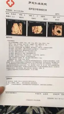 昨天照了四维说唇腭裂好担心,不知道该怎麼办