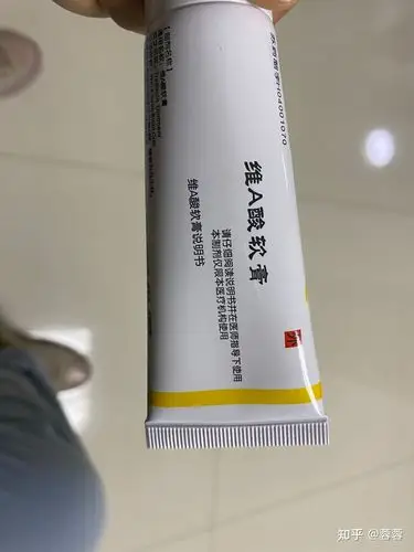 我的跖疣没冷冻涂药涂好了