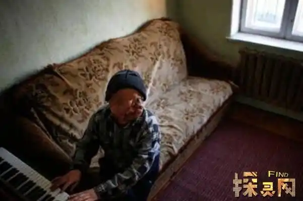 福岛核泄漏后变异的女人相貌被毁性格大变