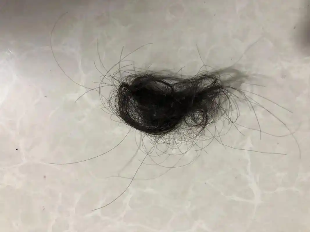 拿起了菜刀骑在我的身上打我头抓我的头发