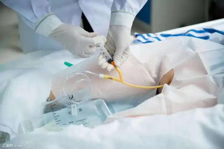 留置尿管的健康教育