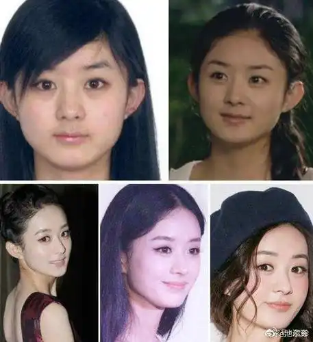 32岁赵丽颖近照甜美粉嫩,网友却说她疑似整容,下巴像杨幂