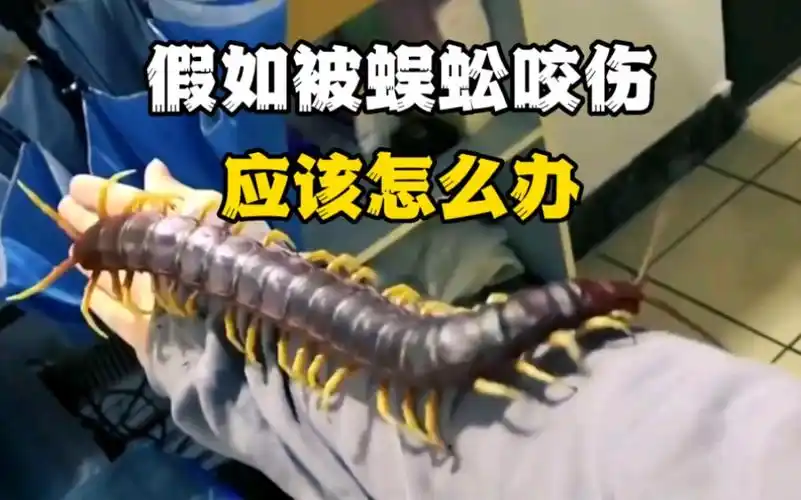 假如被蜈蚣咬伤应该怎么办?