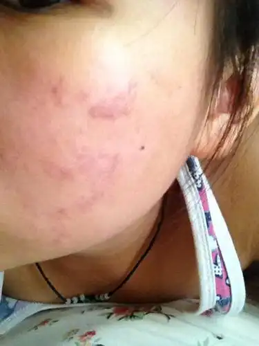 后来就变成黑色的了.怎么办