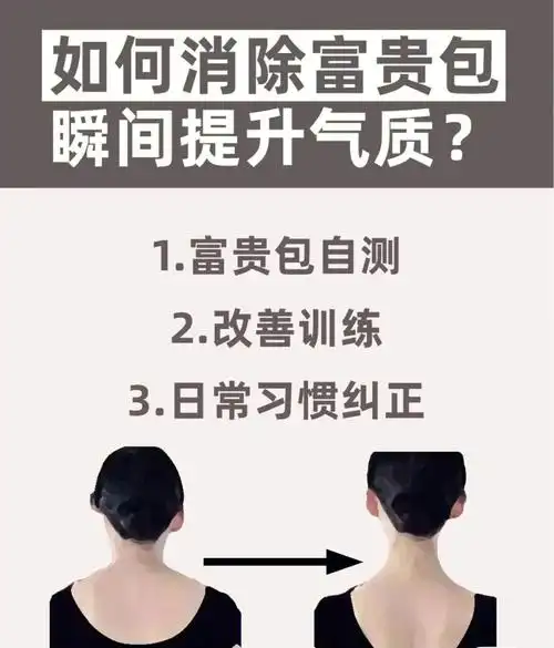 如何消除富贵包提升气质