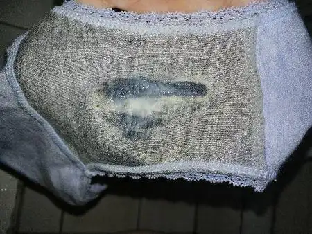 白带粘稠像浆糊图片