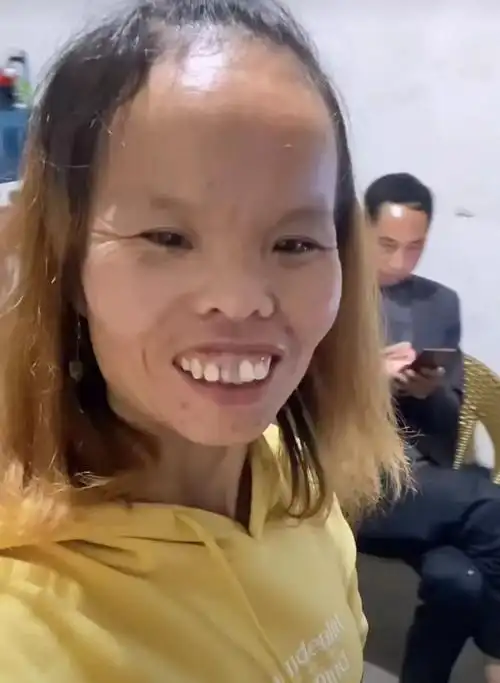 发际线又高一对小眯眼一个塌鼻梁一张大翘嘴五官不协调