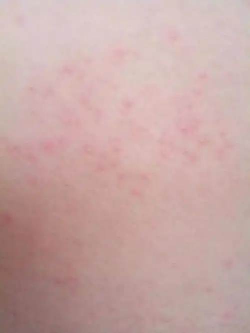 皮肤来说,就像个保护膜,你搓那么狠,都发红带疼的,角质层能不遭到破坏