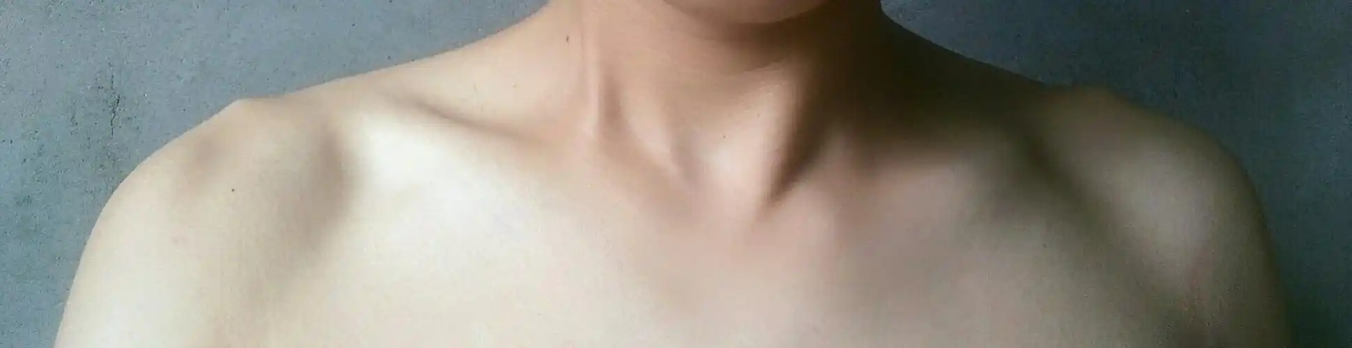 比如支架把锁骨支撑平衡不高低肩?