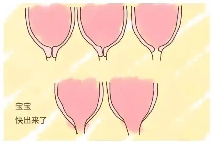 产科医生必须掌握的宫颈成熟度检查方法和要点你掌握了吗