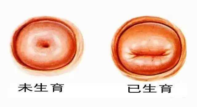 流产|宫颈|人工流产|宫颈口_网易订阅