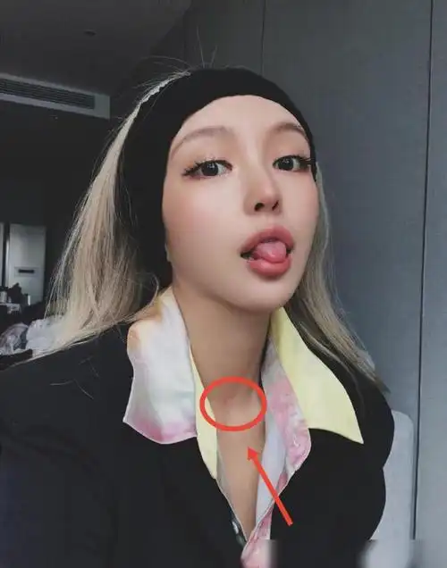 周扬青秒变酷女孩儿脖子红痕引粉丝注意本人回应被兔子抓伤