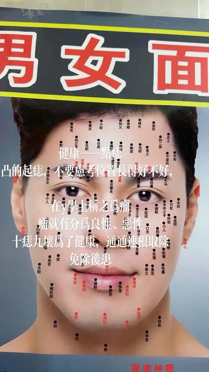 给朋友祛除大瘤痣脸上十痣九杯,有斑有痣不要留 #香港 #眉 - 抖音