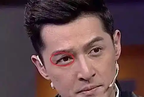 鹿晗,胡歌曾受伤毁容,任家萱,俞灏明浴火重生,盘点明星伤疤