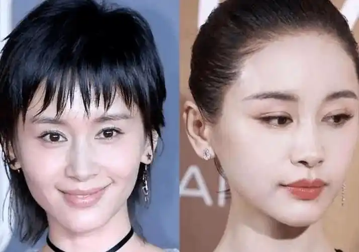 跟王子文学习面部填充大变活人,实现逆龄神话_脂肪_自体_奚梦瑶