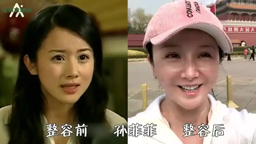 "整容失败"的明星,娄艺潇女神变女鬼,王丽坤素颜女神变僵尸脸,张檬