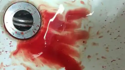 原来真的能被气的"吐"血…… 3.30