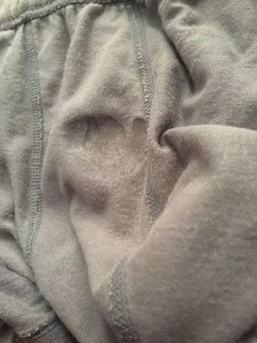 夜里醒来发现遗精量就这么点正常吗