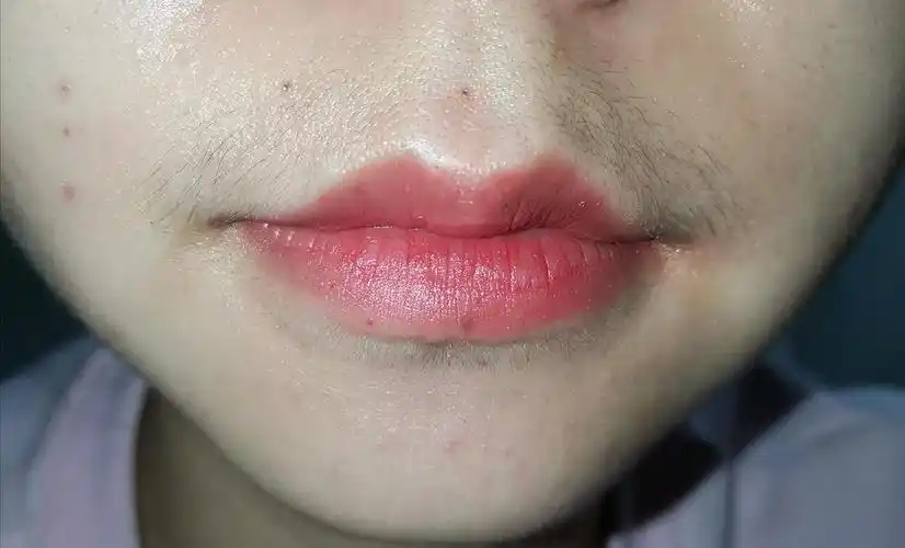 唇毛长打算买一个脱毛膏或脱毛仪