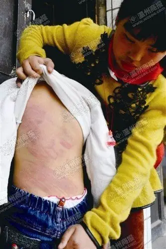 温州7岁女孩因不做作业遭父亲木藤抽打(图)