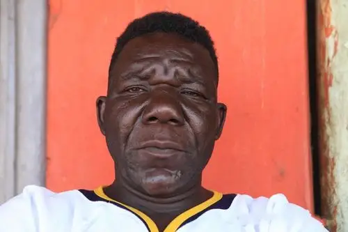 原创世界上最丑的人,5次选丑大赛4次都是冠军,看完根本吃不下饭!