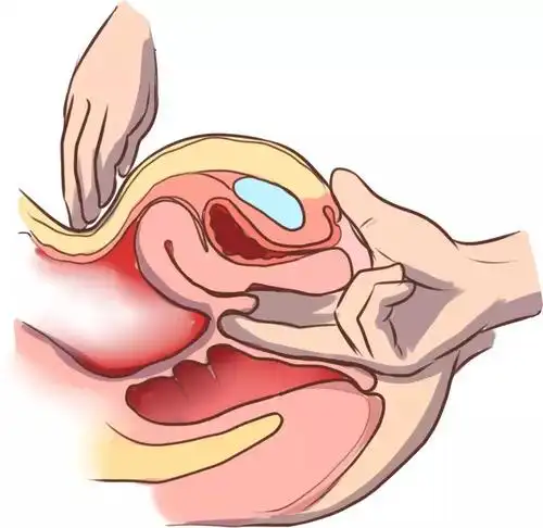 你会觉得很宽敞,当你摸到一个中间有个小孔的东西,那就是宫颈