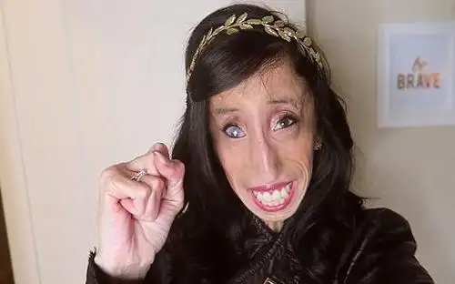 她是全世界最丑的女人,生前红极一时,死后被做成标本展览