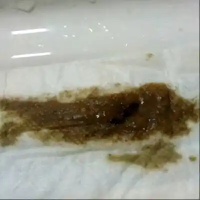 排卵期排出这样的,是什麼东西呀?