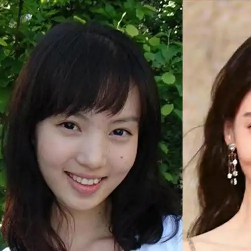 金晨的歪嘴问题在2023年引起了观众的注意,他们认为这可能是整容术的