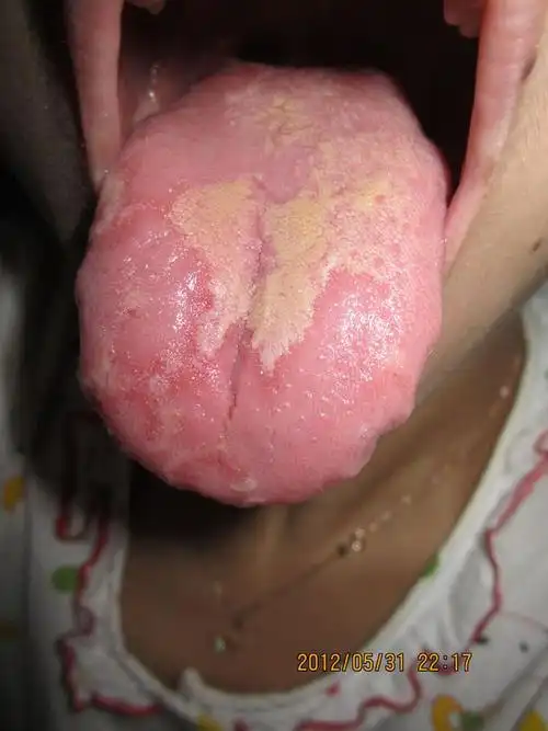 大便不是怎么正常,东西吃多了一点,胃就不舒服,这是为什么