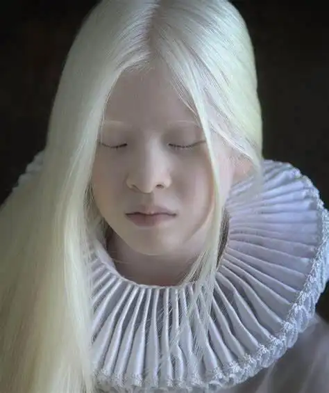 亚洲人?白化病弃儿在荷兰开启全新的精彩人生